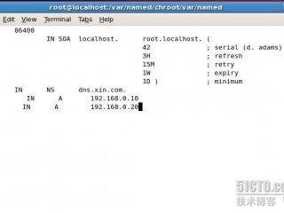 linux中dns服务器如何配置